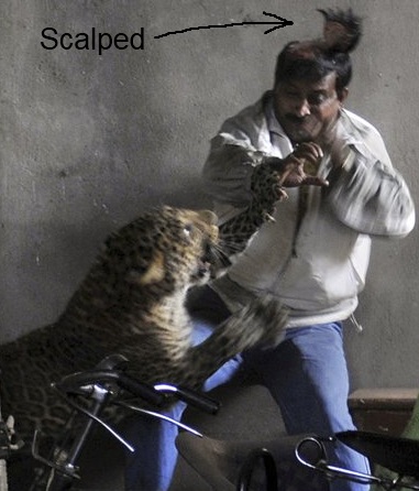 Man scalped by a leopard in Guwahati India